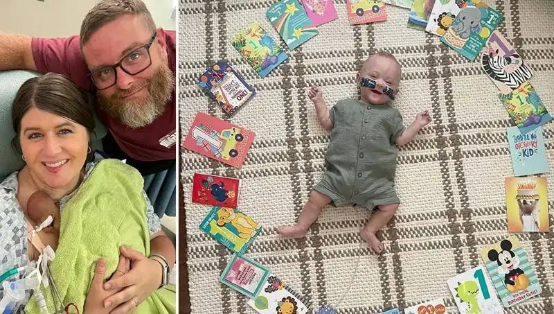 Dünyanın En Prematüre Bebeği 280 Gram Doğdu: Doktorlar Yaşamaz Dedi Ama...
