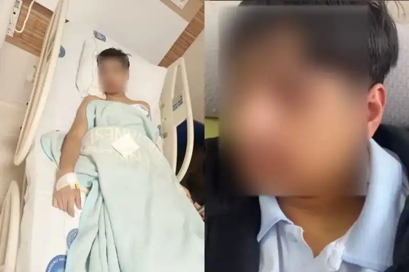 Antalya’da Akran Zorbalığı: Arkadaşının Çenesini Kıran Şok Edici Olay