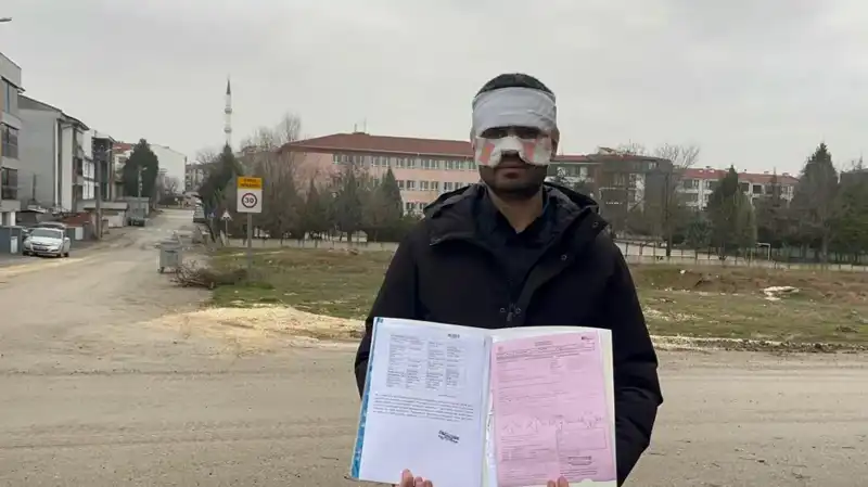 Öğretmenlerden Şok Edici Olay: Sıcak Çayla Yüzüne Fırlatıldı!