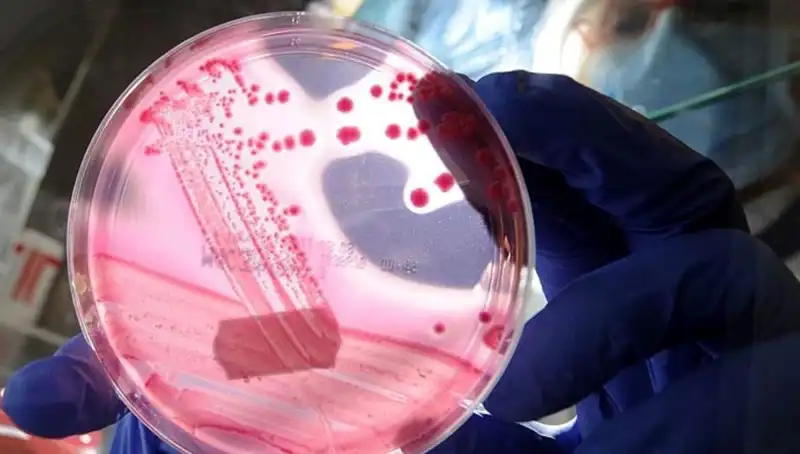 Bilim İnsanları AP2A1 Proteini ile Yaşlanmayı Tercih Etmeyen Keşif Yaptı!