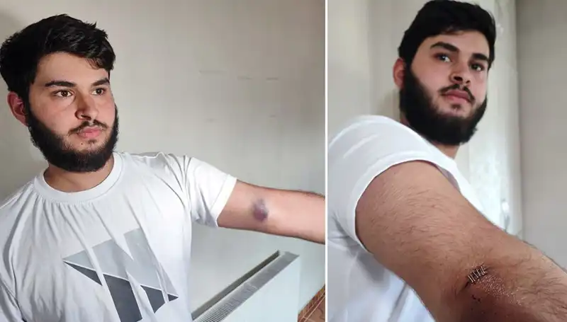 Bahçeye Kaçan Top, Mahalledeki Gerilimi Tırmandırdı: "Conolar Kamyonetle Geldi!"
